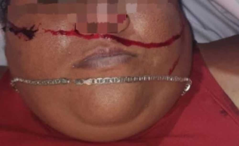 Desvelan Identidad de Mujer Ejecutada en la Colonia Nuevo Progreso y Detallan el Ataque