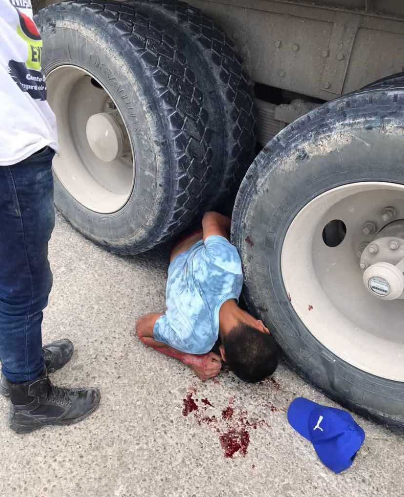 Motociclista colisionado por un volquete en la Ribera del Rio Hondo un accidente impactante 1