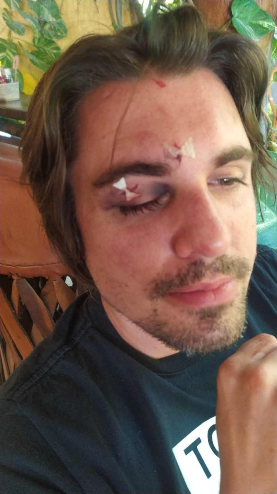 Ataque a Médico Francés en Holbox Desata Preocupación por Lesiones Internas y Clamor contra la Impunidad