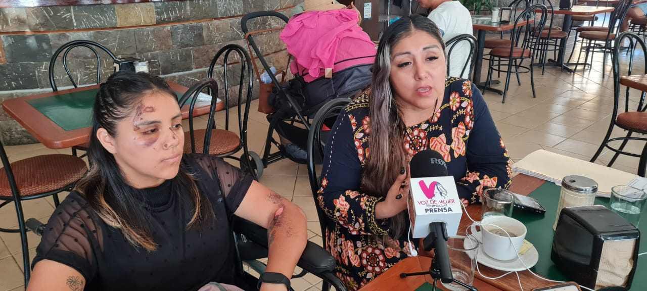 Llamado a la Comunidad: En Busca del Conductor que Huyó Tras Atropellar a Joven en Playa del Carmen